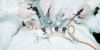 Laparoscopy