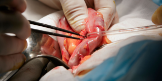 Electrosurgery
