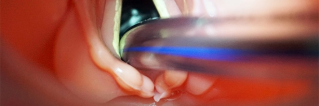 Laryngoscopy