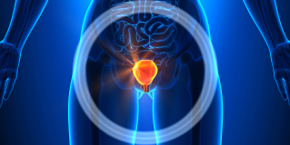 Cystoscopy