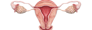 Hysteroscopy